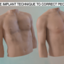 animation 3D medical
